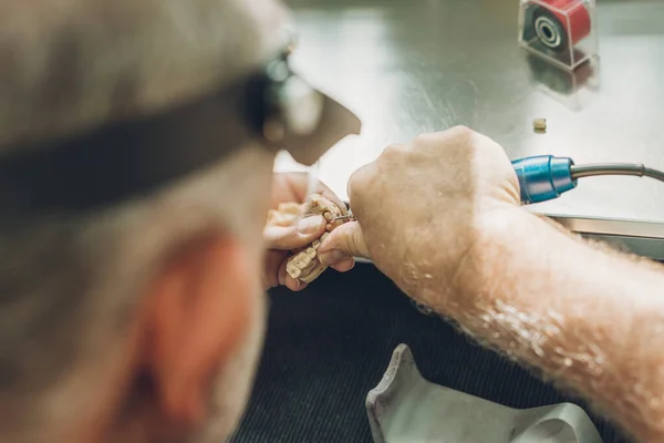 Vista ravvicinata delle mani di un uomo che regolano uno stampo dentale utilizzando un micromotore elettrico in un laboratorio dentale — Foto Stock