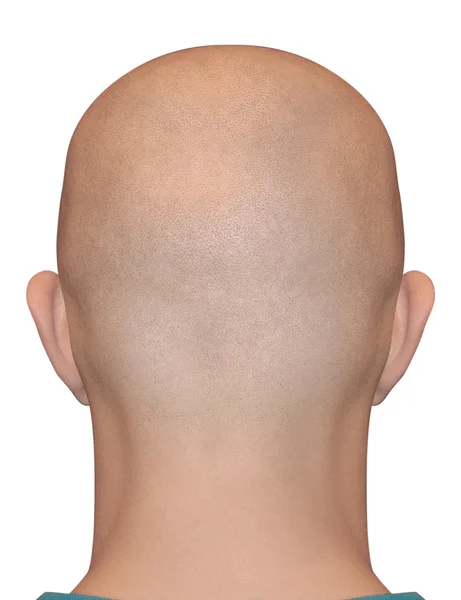 剃掉人类男性秃头头颈部 — 图库照片