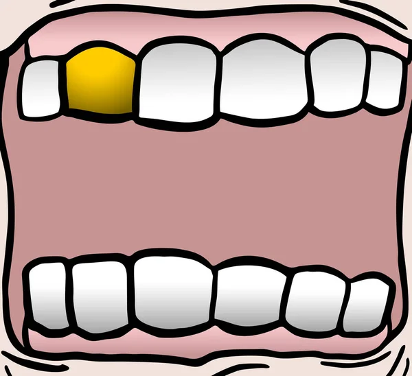 Gold Teeth Vector Illustration — 图库矢量图片