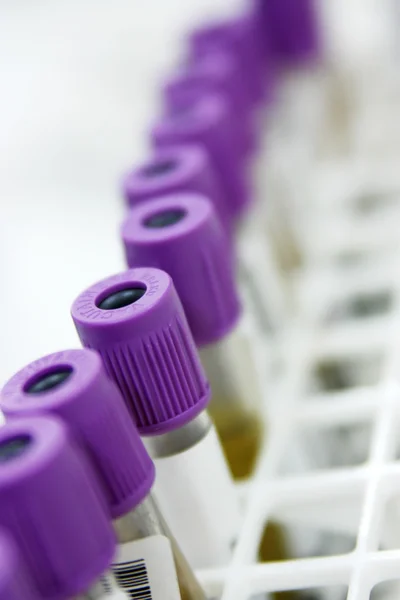 Rack com tubos de ensaio de sangue — Fotografia de Stock
