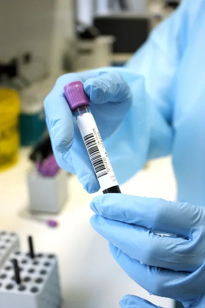 El ile test tüp kan