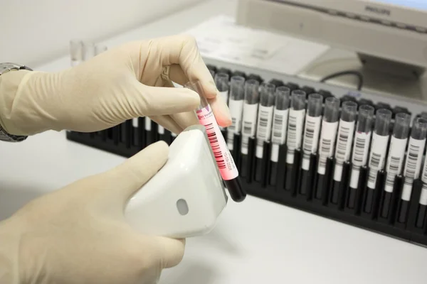 El ile test tüp kan