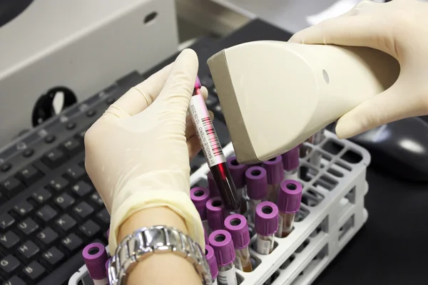 El ile test tüp kan