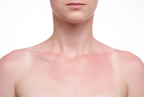 Tanned skin in the sun — Stock Photo, Image