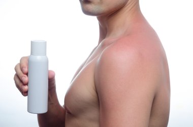 Kurtarma krem cilt güneşte yanmış.