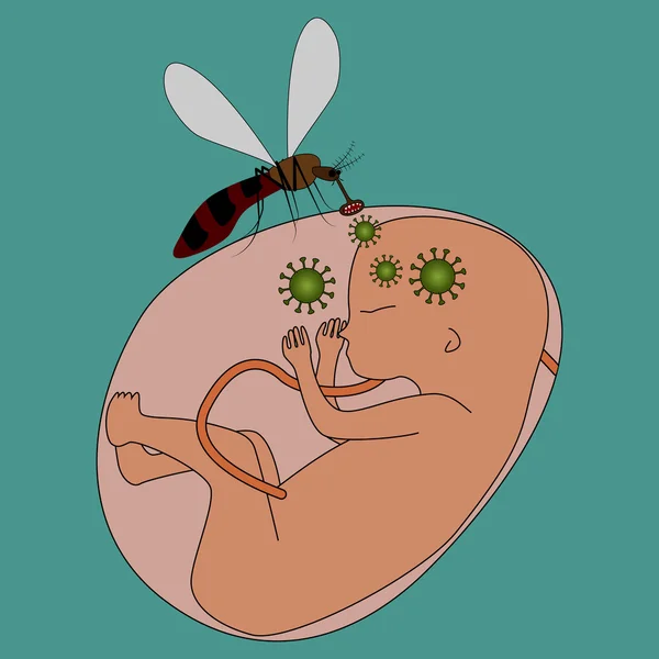 Zika virüs bir sivrisinek ısırması ile bulaşan