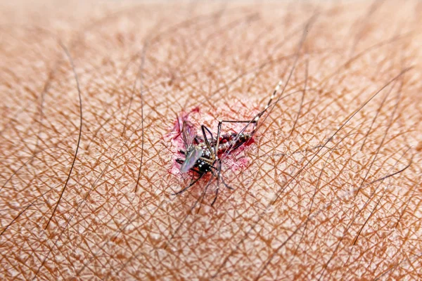 Γκρο πλαν έσπασαν κουνουπιού (Aedes aegypti) πιπίλισμα του αίματος για να πεθάνει στο ανθρώπινο δέρμα., κουνούπι που είναι φορέας του ιού της ελονοσίας, εγκεφαλίτιδα, ο δάγκειος πυρετός και Ζήκα. — Φωτογραφία Αρχείου