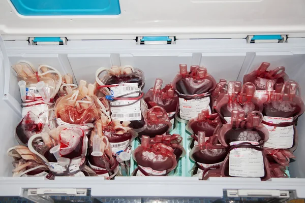 Blood donation, Human blood from donor storage in plastic contai — Stock Photo, Image