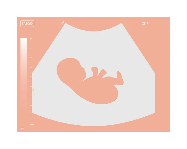 Medizinisches Ultraschalldiagnostikgerät mit Embryo auf dem Bildschirm — Stockvektor