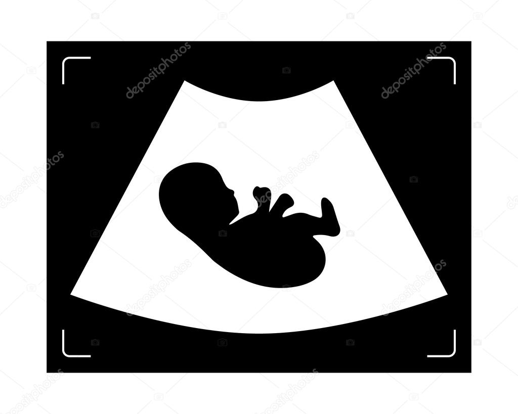 画面上の胚で医療超音波診断機 ストックベクター C Seydouxx