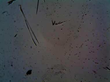 Etraftaki rastgele şeylerin mikroskobik fotoğrafları