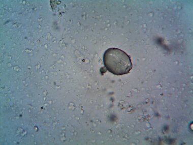 Çevrede bulunan pek çok şeyin mikroskobik fotoğrafı