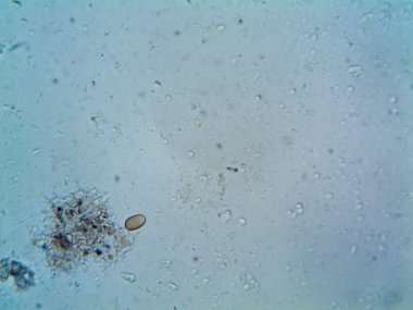 Çevrede bulunan pek çok şeyin mikroskobik fotoğrafı