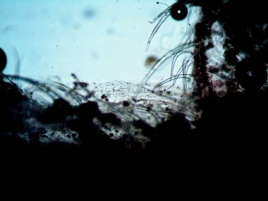 Kenevirin mikroskobik fotoğrafı. Limon Suyu ve Mor Limon İndirme