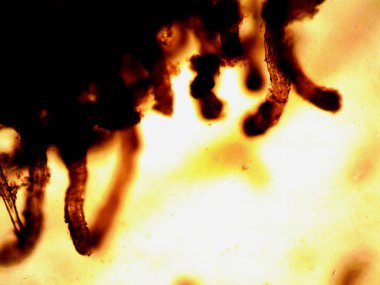 Kenevirin mikroskobik fotoğrafı. Limon Suyu ve Mor Limon İndirme