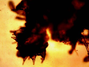 Kenevirin mikroskobik fotoğrafı. Limon Suyu ve Mor Limon İndirme