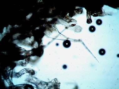 Kenevirin mikroskobik fotoğrafı. Limon Suyu ve Mor Limon İndirme