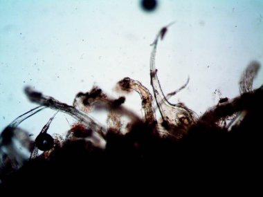 Kenevirin mikroskobik fotoğrafı. Limon Suyu ve Mor Limon İndirme