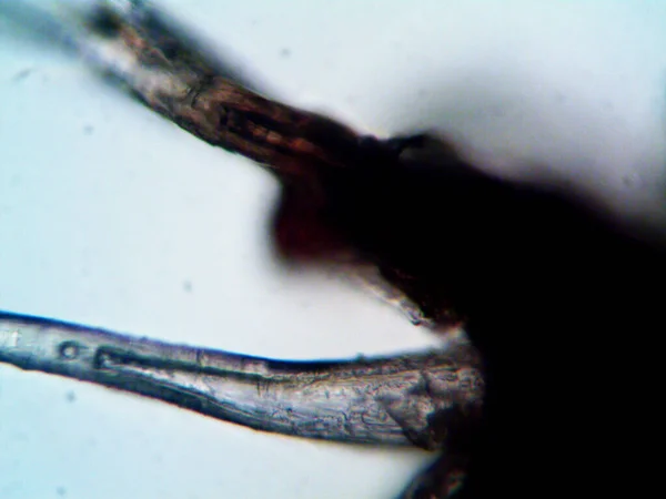 Kenevirin mikroskobik fotoğrafı. Limon ve mor limon mautoflanmaktadır.