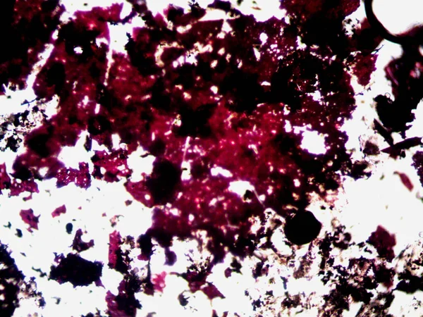 Mikroskopijne Zdjęcie Samobieżnych Kryształów — Zdjęcie stockowe