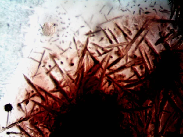 Tuhaf kimyasal deneyimin mikroskobik fotoğrafları.