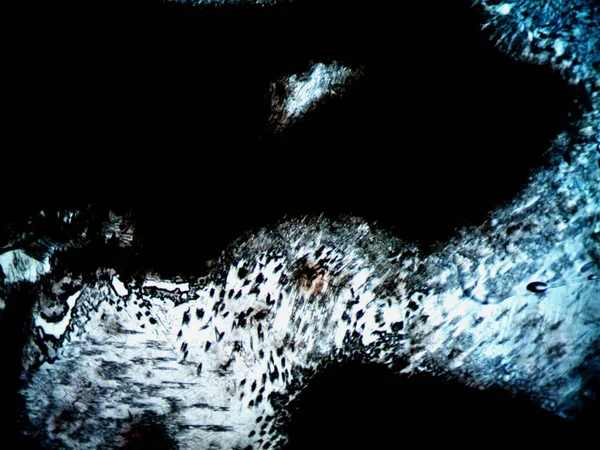 Tuhaf kimyasal deneyimin mikroskobik fotoğrafları.