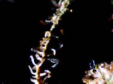 Lavabonun altındaki kirli suyun bakteri fotoğrafları.