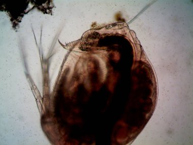 Mikroskop, kirli su ve bulduğum tüm organizmalar.