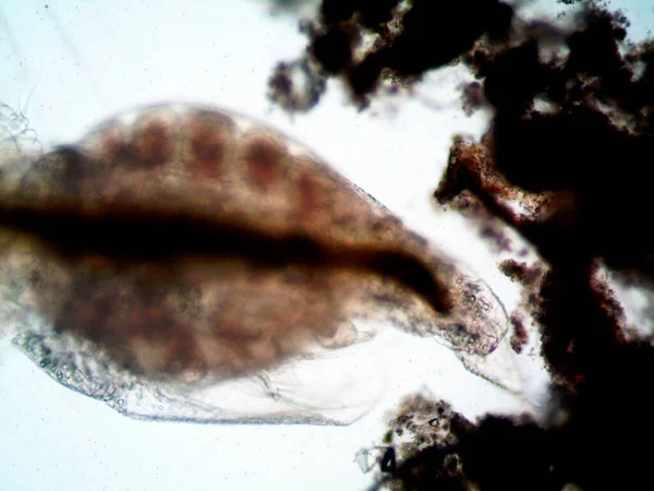 Mikroskop Schmutzwasser Und Alle Gefundenen Organismen — Stockfoto