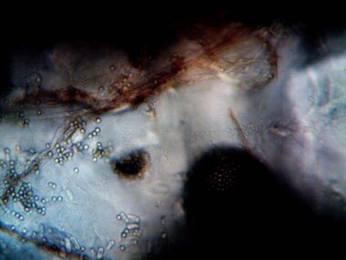 Etrafta yaşayan mikroorganizmaların mikroskobik fotoğrafı