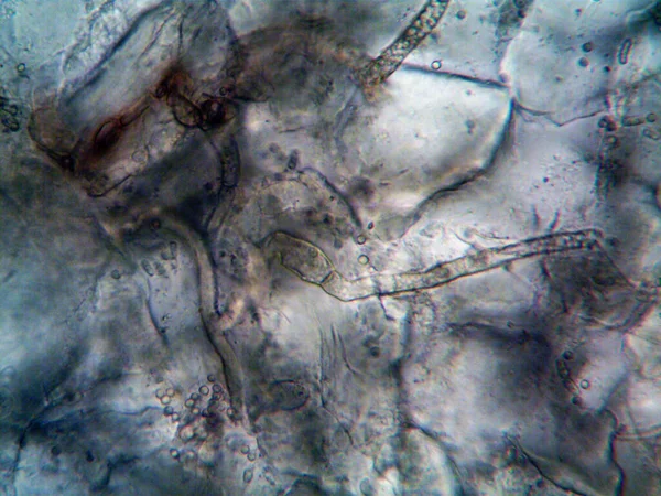 Foto Microscopica Microrganismi Che Vivono Intorno — Foto Stock
