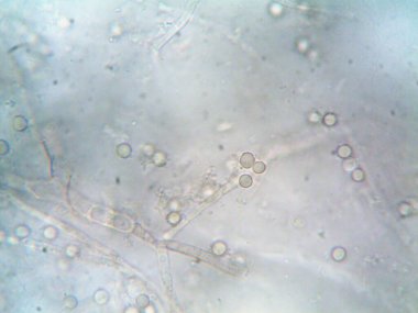 Mikroskopi, benim tarafımdan bulunan orantısızlığın fotoğrafı.