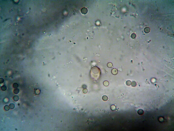 Microscopía Foto Del Oranismo Encontrado Por — Foto de Stock