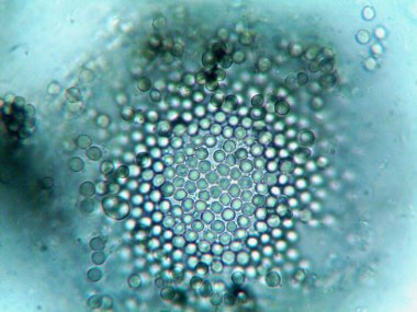 Mikroskopi, benim tarafımdan bulunan orantısızlığın fotoğrafı.