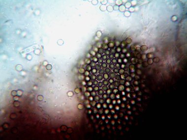 Ev yapımı mikroorganizmaların mikroskobik fotoğrafı