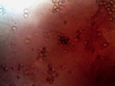 Ev yapımı mikroorganizmaların mikroskobik fotoğrafı