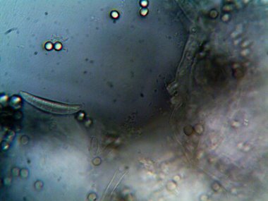 Ev yapımı mikroorganizmaların mikroskobik fotoğrafı