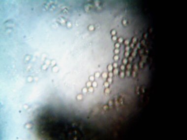 Ev yapımı mikroorganizmaların mikroskobik fotoğrafı