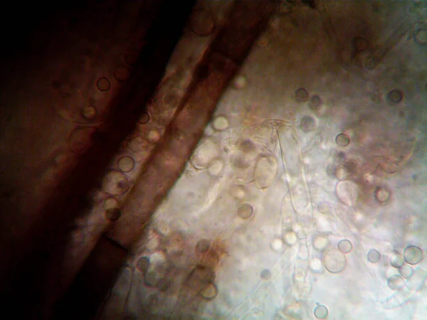 Microscopy Photo Oranism Found — Stock Photo, Image