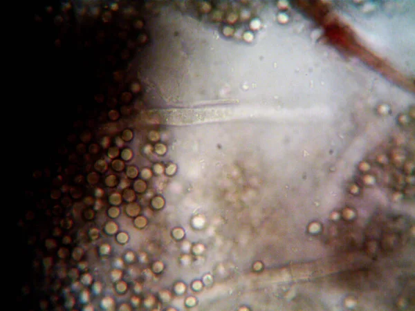 Microscopía Foto Del Oranismo Encontrado Por —  Fotos de Stock