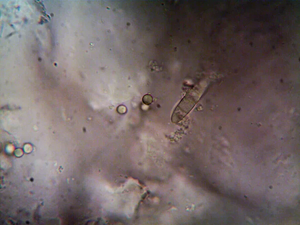 Microscopie Fotografie Oranism Găsită Mine — Fotografie, imagine de stoc