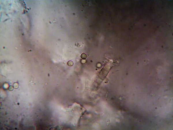 Microscopía Foto Del Oranismo Encontrado Por — Foto de Stock