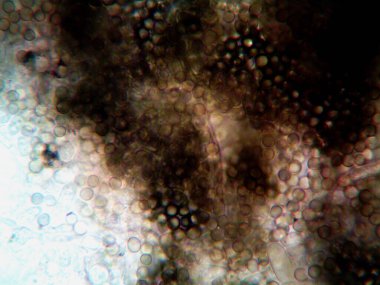 Ev yapımı mikroorganizmaların mikroskobik fotoğrafı