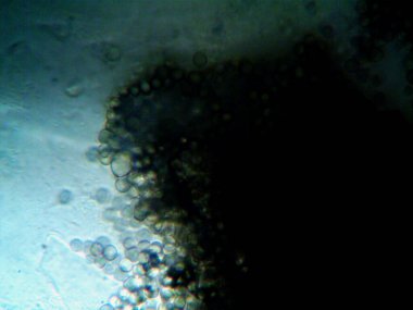 Ev yapımı mikroorganizmaların mikroskobik fotoğrafı