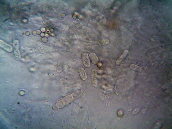 Ev yapımı mikroorganizmaların mikroskobik fotoğrafı