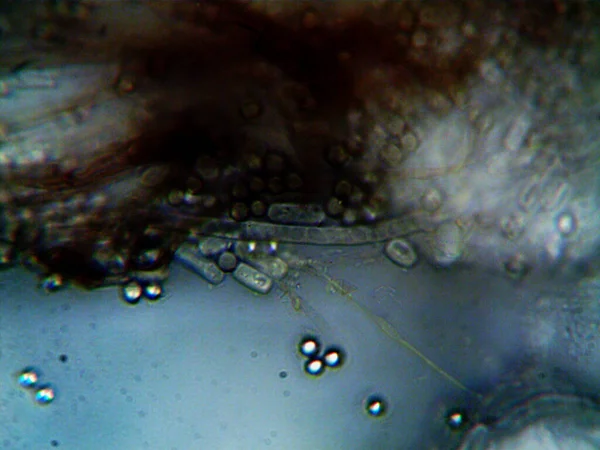 Microscopic Photo Home Made Microorganisms — Stock Photo, Image