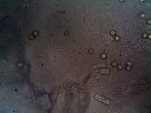 Photo Microscopique Micro Organismes Faits Maison — Photo