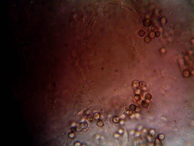 Ev yapımı mikroorganizmaların mikroskobik fotoğrafı