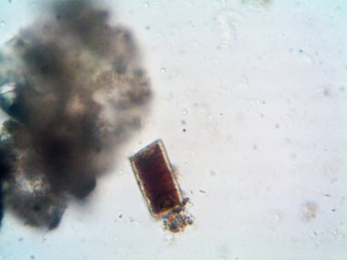 Ev yapımı mikroorganizmaların mikroskobik fotoğrafı