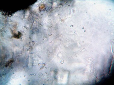 Ev yapımı mikroorganizmaların mikroskobik fotoğrafı